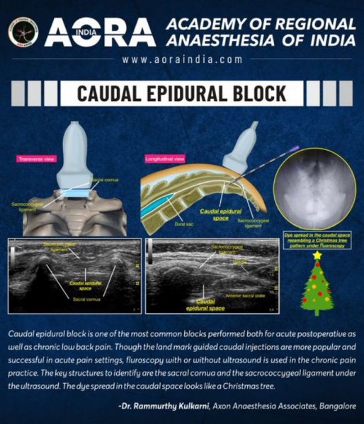 File:Caudal-Kulkarni.jpeg